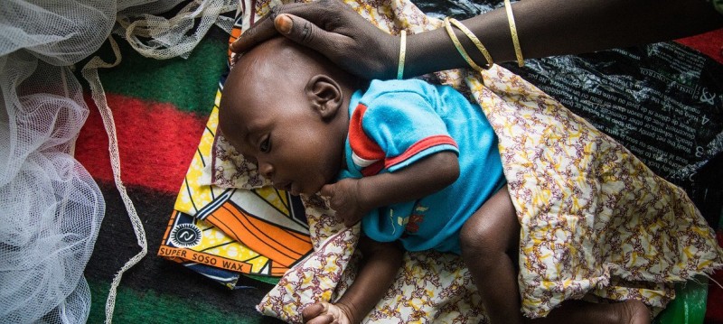 Horn of Africa: Over 7 million children under the age of 5 remain malnourished